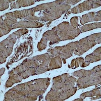  - Anti-Alpha-actin-1 Antibody AP61565